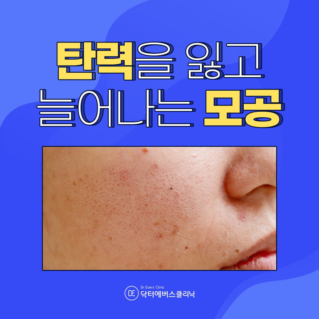 피코프락셀 구로피부과 닥터에버스