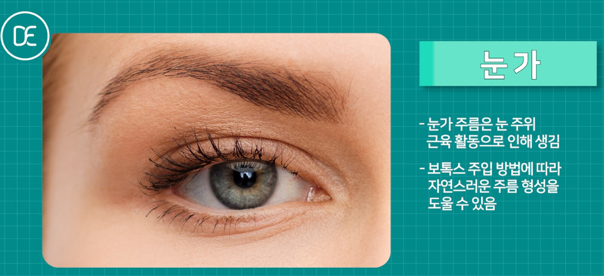 눈가보톡스 구로피부과 닥터에버스