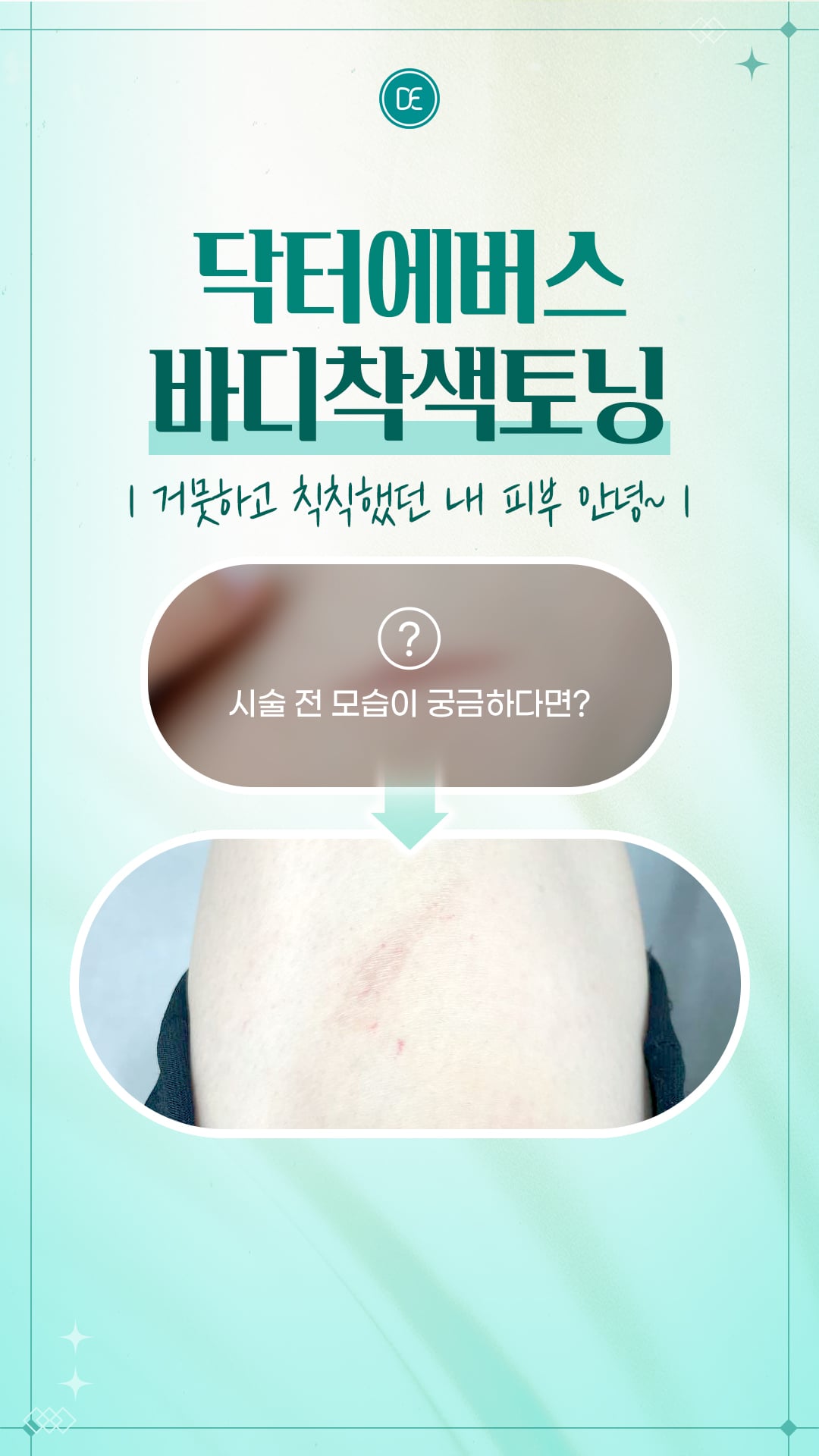 구로피부과 닥터에버스